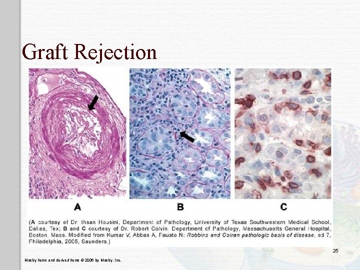 Graft Rejection 25 Mosby items and derived items © 2006 by Mosby, Inc. 