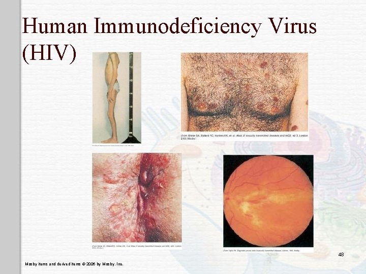 Human Immunodeficiency Virus (HIV) 48 Mosby items and derived items © 2006 by Mosby,