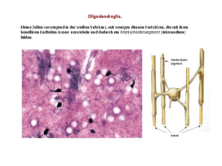 Oligodendroglia. Kleine Zellen vorwiegend in der weißen Substanz, mit wenigen dünnen Fortsätzen, die mit