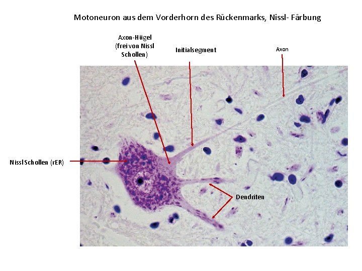 Motoneuron aus dem Vorderhorn des Rückenmarks, Nissl- Färbung Axon-Hügel (frei von Nissl Schollen) Initialsegment
