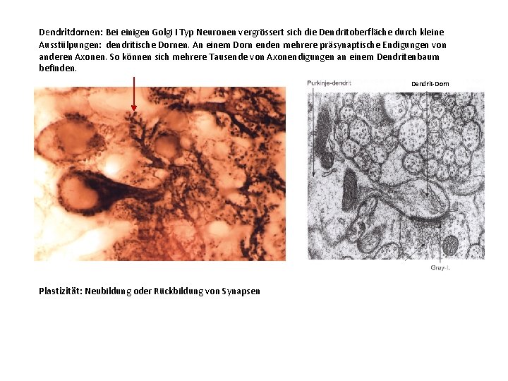 Dendritdornen: Bei einigen Golgi I Typ Neuronen vergrössert sich die Dendritoberfläche durch kleine Ausstülpungen: