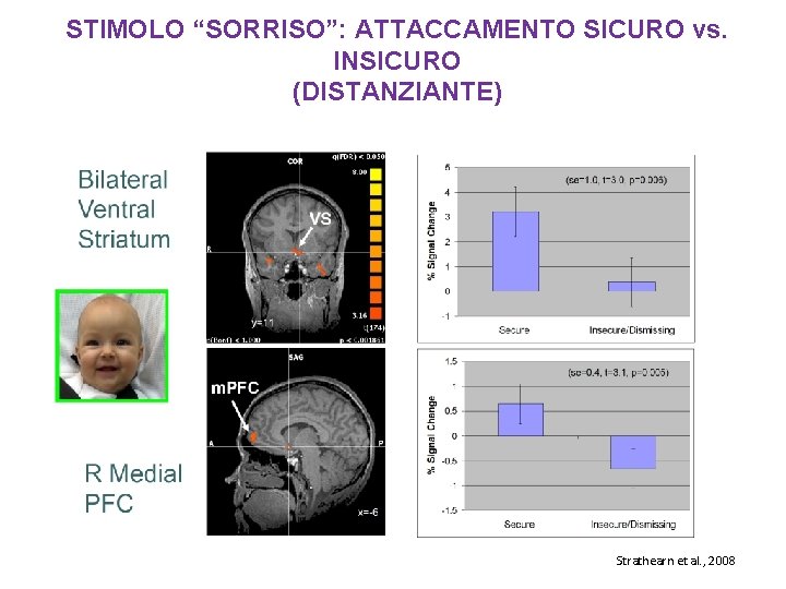 STIMOLO “SORRISO”: ATTACCAMENTO SICURO vs. INSICURO (DISTANZIANTE) Strathearn et al. , 2008 