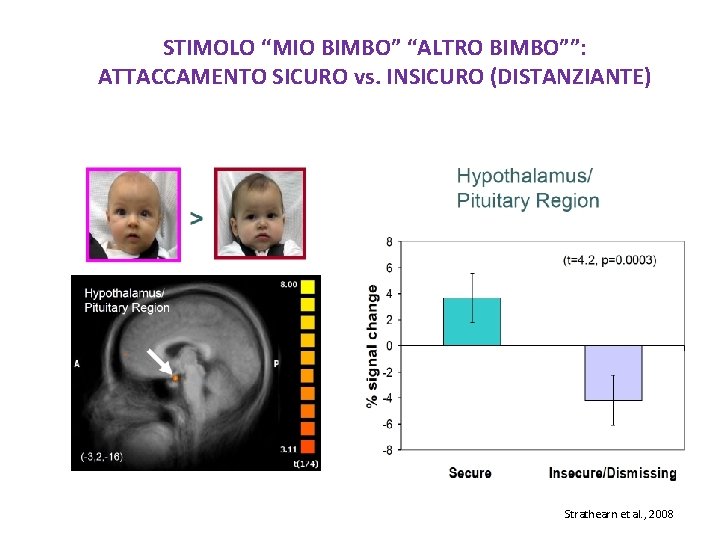 STIMOLO “MIO BIMBO” “ALTRO BIMBO””: ATTACCAMENTO SICURO vs. INSICURO (DISTANZIANTE) Strathearn et al. ,