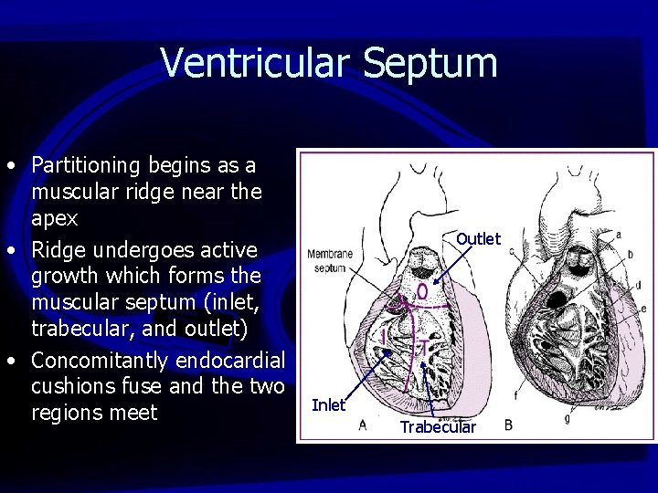 Ventricular Septum • Partitioning begins as a muscular ridge near the apex • Ridge
