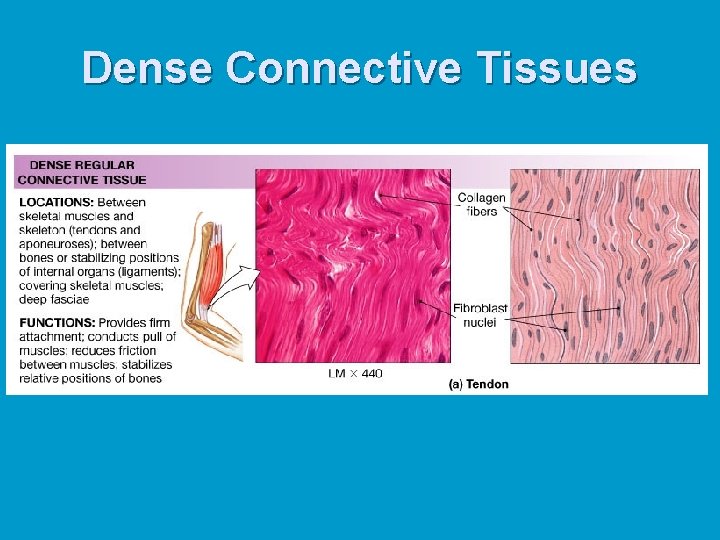 Dense Connective Tissues 