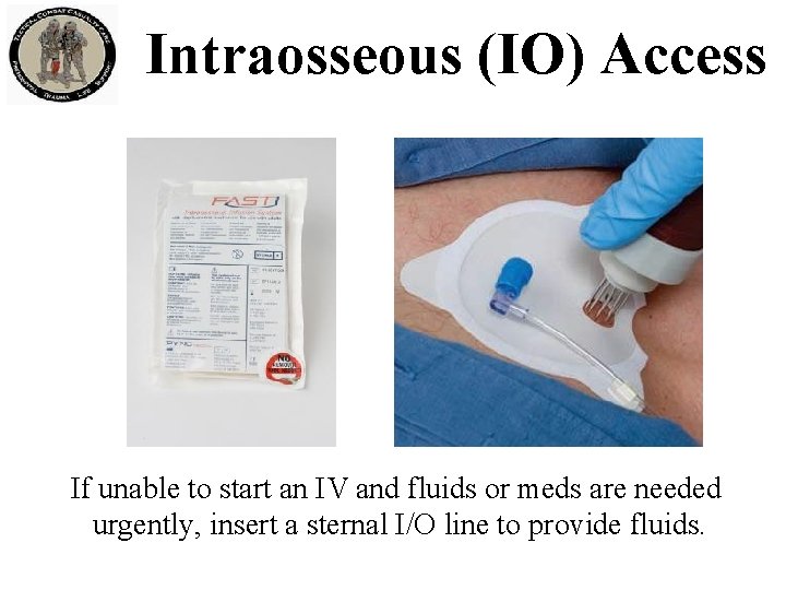 Intraosseous (IO) Access If unable to start an IV and fluids or meds are Intraosseous (IO) Access If unable to start an IV and fluids or meds are