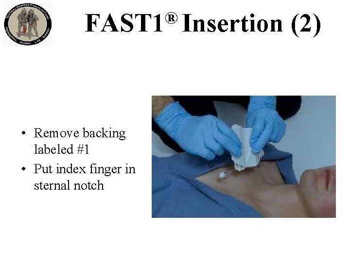 ® FAST 1 Insertion • Remove backing labeled #1 • Put index finger in ® FAST 1 Insertion • Remove backing labeled #1 • Put index finger in