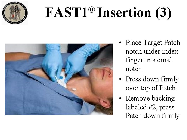 ® FAST 1 Insertion (3) • Place Target Patch notch under index finger in ® FAST 1 Insertion (3) • Place Target Patch notch under index finger in