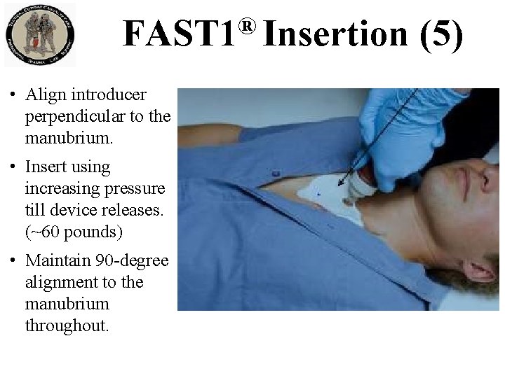 ® FAST 1 Insertion • Align introducer perpendicular to the manubrium. • Insert using ® FAST 1 Insertion • Align introducer perpendicular to the manubrium. • Insert using