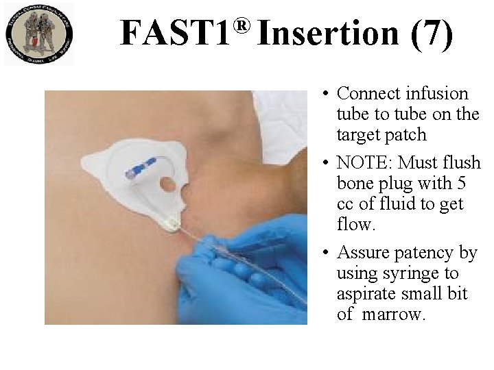 ® FAST 1 Insertion (7) • Connect infusion tube to tube on the target ® FAST 1 Insertion (7) • Connect infusion tube to tube on the target