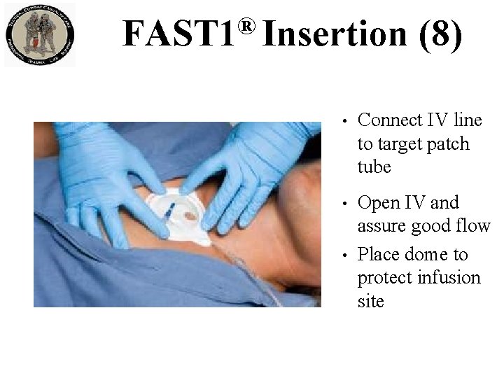 ® FAST 1 Insertion (8) • Connect IV line to target patch tube • ® FAST 1 Insertion (8) • Connect IV line to target patch tube •