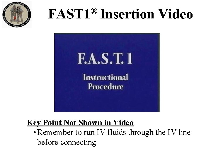 FAST 1® Insertion Video Key Point Not Shown in Video • Remember to run FAST 1® Insertion Video Key Point Not Shown in Video • Remember to run