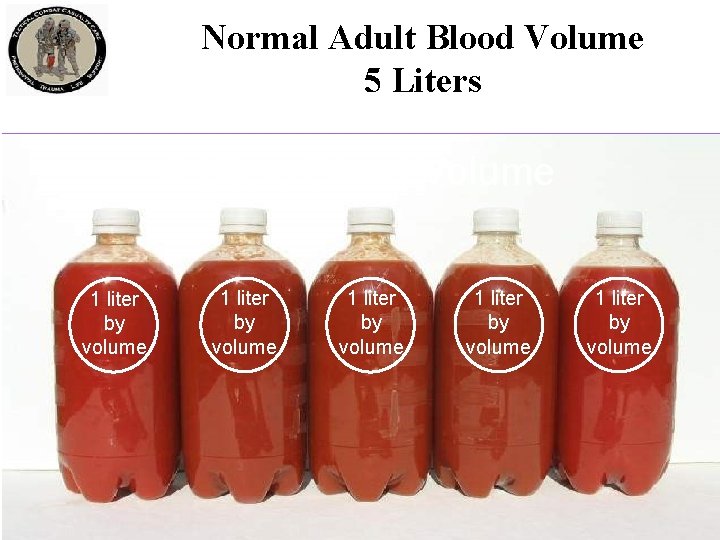 Normal Adult Blood Volume 5 Liters Blood Volume 1 liter by volume 1 liter Normal Adult Blood Volume 5 Liters Blood Volume 1 liter by volume 1 liter
