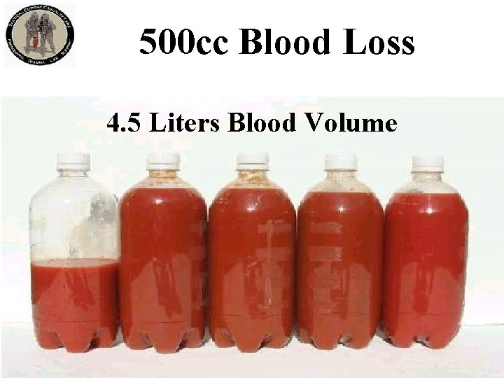 500 cc Blood Loss 4. 5 Liters Blood Volume 500 cc Blood Loss 4. 5 Liters Blood Volume