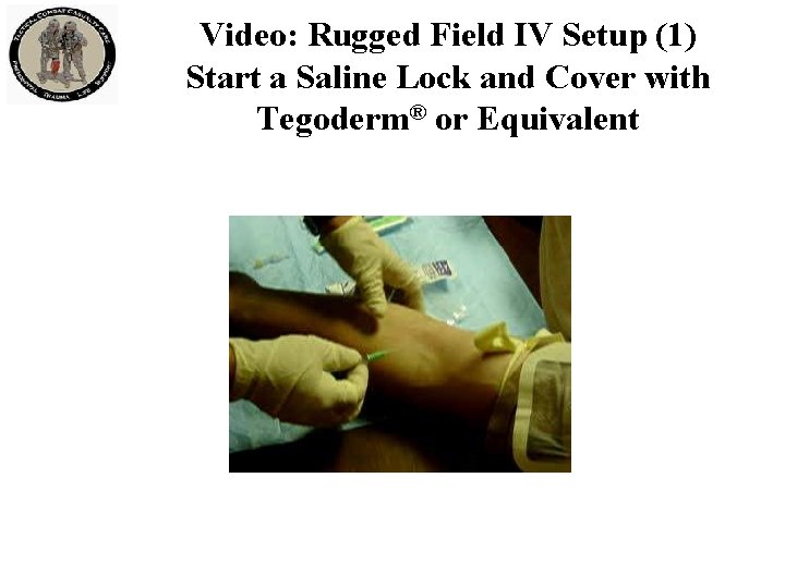 Video: Rugged Field IV Setup (1) Start a Saline Lock and Cover with Tegoderm® Video: Rugged Field IV Setup (1) Start a Saline Lock and Cover with Tegoderm®