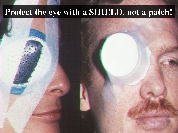 Protect the eye with a SHIELD, not a patch! Protect the eye with a SHIELD, not a patch!