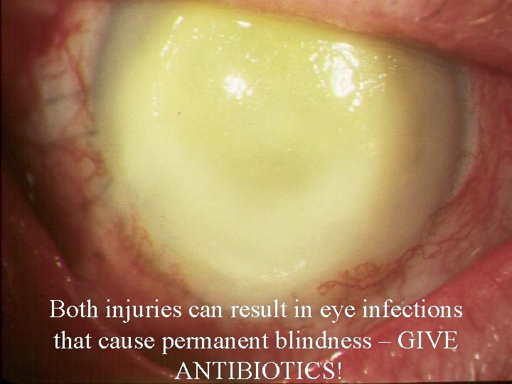 Both injuries can result in eye infections that cause permanent blindness – GIVE ANTIBIOTICS! Both injuries can result in eye infections that cause permanent blindness – GIVE ANTIBIOTICS!