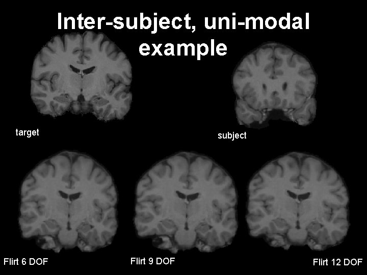Inter-subject, uni-modal example target Flirt 612/13/2011 DOF subject Flirt 9 DOF Flirt 12 DOF