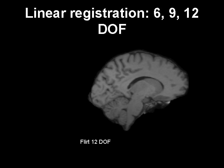 Linear registration: 6, 9, 12 DOF Flirt 6 DOF 9 target subject Flirt 12