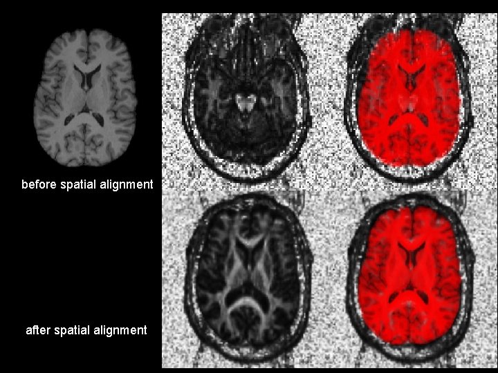 before spatial alignment after spatial alignment 