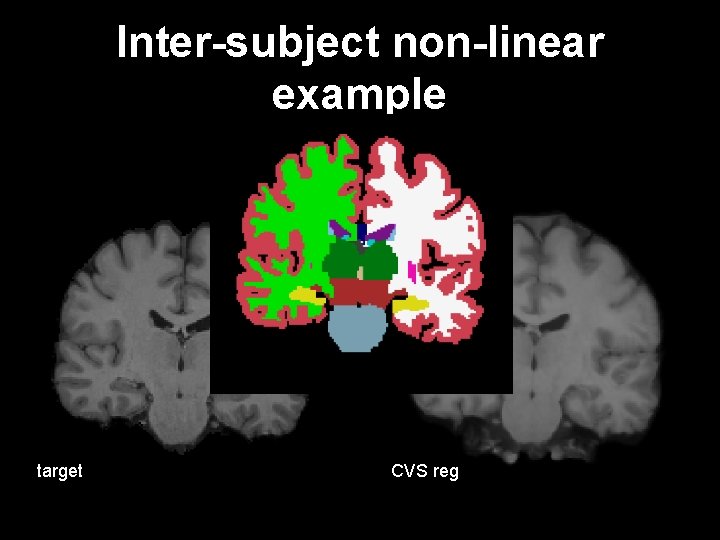 Inter-subject non-linear example target CVS reg 