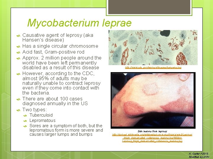 Mycobacterium leprae Causative agent of leprosy (aka Hansen’s disease) Has a single circular chromosome