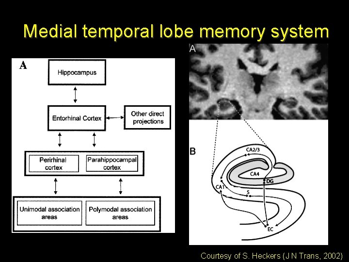 Medial temporal lobe memory system Courtesy of S. Heckers (J N Trans, 2002) 