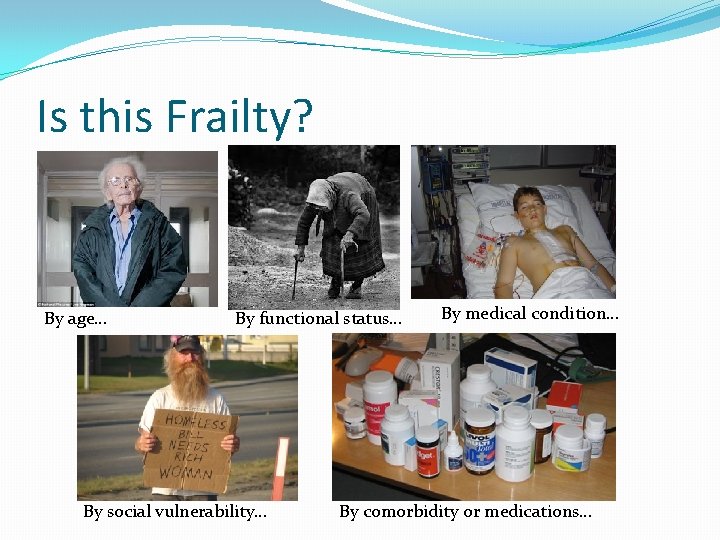 Is this Frailty? By age… By functional status… By social vulnerability… By medical condition…