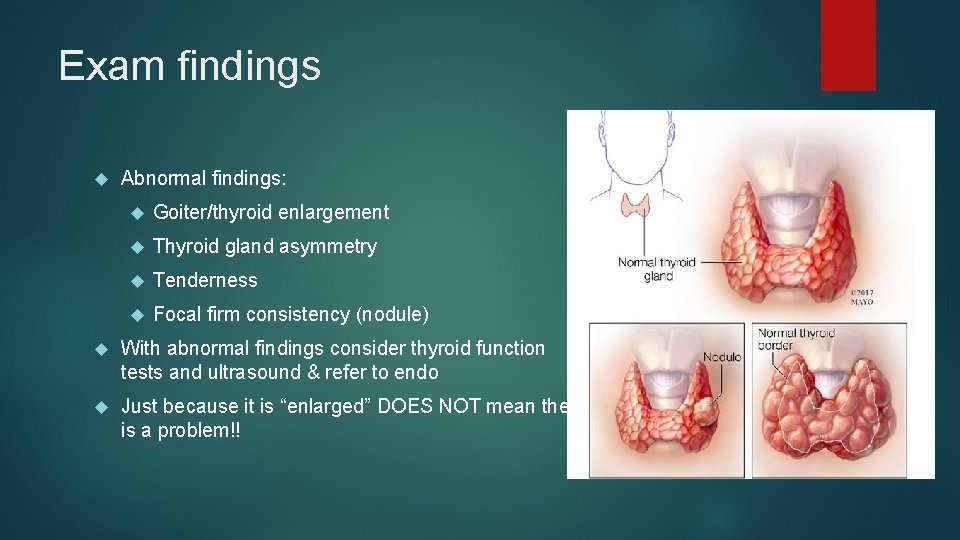 Exam findings Abnormal findings: Goiter/thyroid enlargement Thyroid gland asymmetry Tenderness Focal firm consistency (nodule)