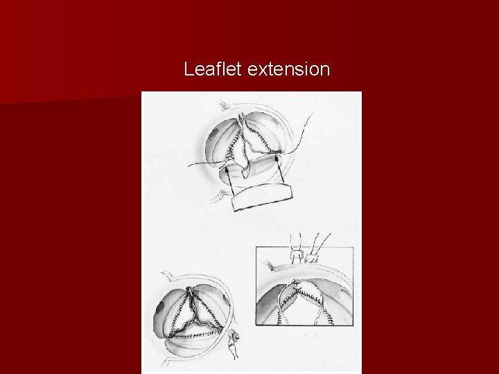 Leaflet extension 