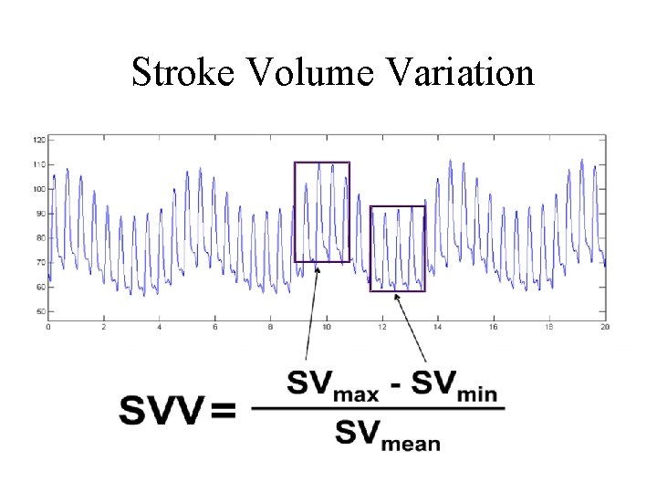 Stroke Volume Variation 