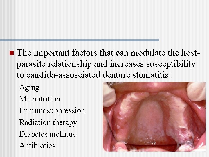 n The important factors that can modulate the hostparasite relationship and increases susceptibility to