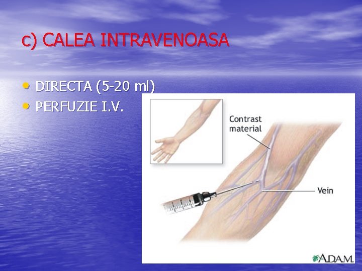 c) CALEA INTRAVENOASA • DIRECTA (5 -20 ml) • PERFUZIE I. V. 