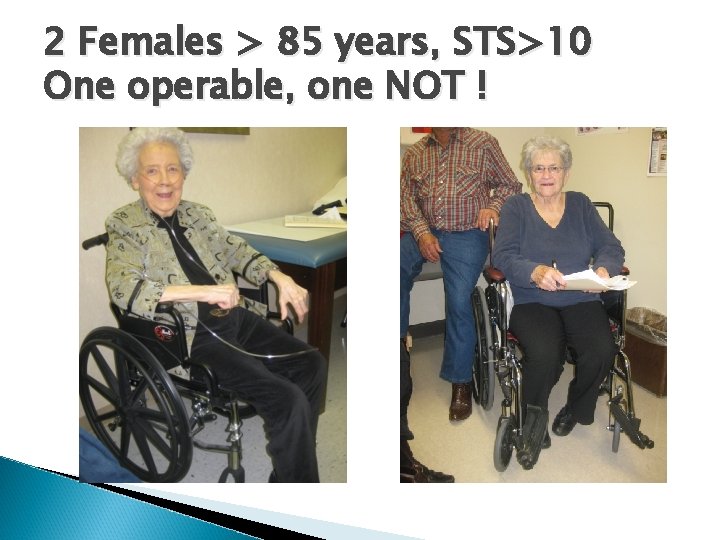 2 Females > 85 years, STS>10 One operable, one NOT ! 