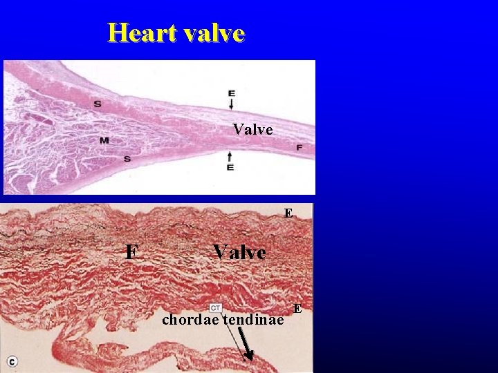 Heart valve Valve E F Valve chordae tendinae E Heart valve Valve E F Valve chordae tendinae E