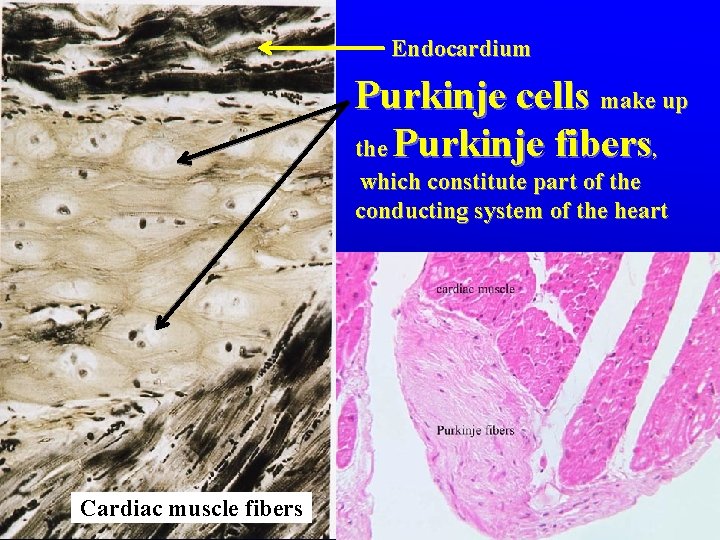 Endocardium Purkinje cells make up the Purkinje fibers, which constitute part of the conducting Endocardium Purkinje cells make up the Purkinje fibers, which constitute part of the conducting