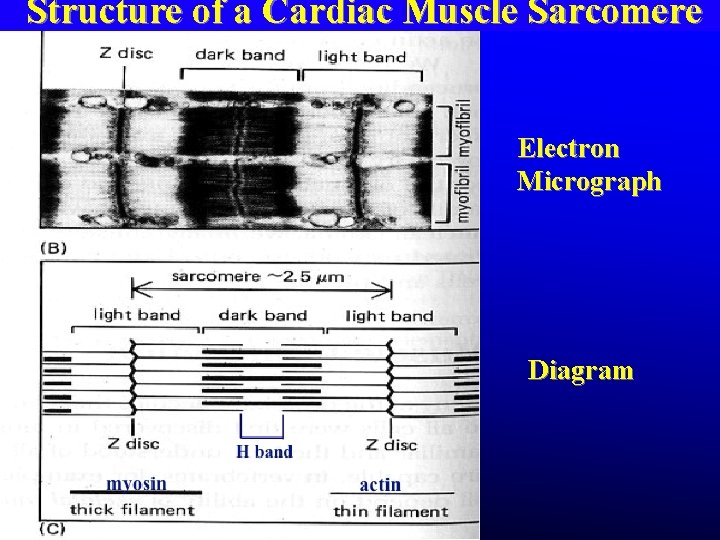 Structure of a Cardiac Muscle Sarcomere Electron Micrograph Diagram Structure of a Cardiac Muscle Sarcomere Electron Micrograph Diagram