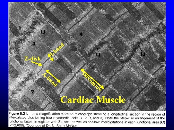 Z-disk d n a b I e er om rc sa Aba nd Cardiac Z-disk d n a b I e er om rc sa Aba nd Cardiac