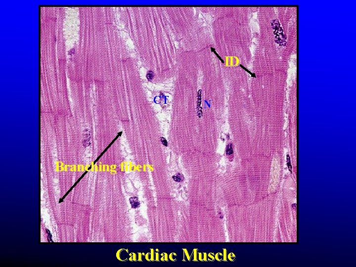 ID CT N Branching fibers Cardiac Muscle ID CT N Branching fibers Cardiac Muscle