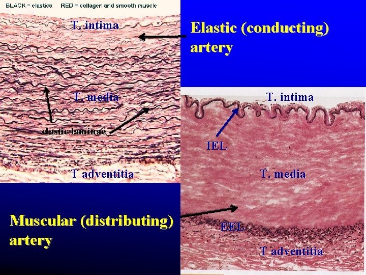 T. intima Elastic (conducting) artery T. media T. intima elastic laminae IEL T adventitia T. intima Elastic (conducting) artery T. media T. intima elastic laminae IEL T adventitia