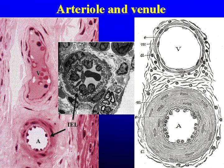 Arteriole and venule V IEL A Arteriole and venule V IEL A