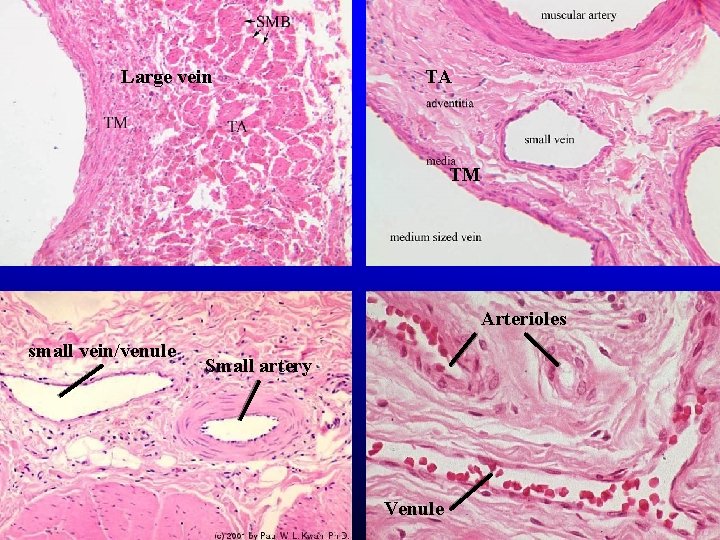 Large vein TA TM Arterioles small vein/venule Small artery Venule Large vein TA TM Arterioles small vein/venule Small artery Venule