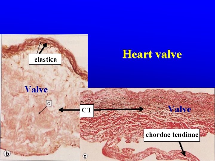 Heart valve elastica Valve CT Valve chordae tendinae Heart valve elastica Valve CT Valve chordae tendinae