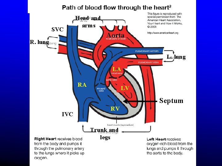 SVC Head and arms Aorta R. lung LA RA LV Septum IVC RV Trunk SVC Head and arms Aorta R. lung LA RA LV Septum IVC RV Trunk