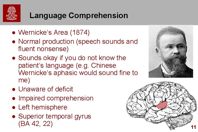 Language Comprehension l l l l Wernicke’s Area (1874) Normal production (speech sounds and