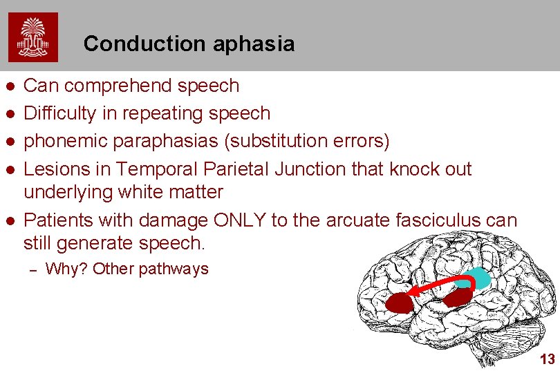 Conduction aphasia l l l Can comprehend speech Difficulty in repeating speech phonemic paraphasias