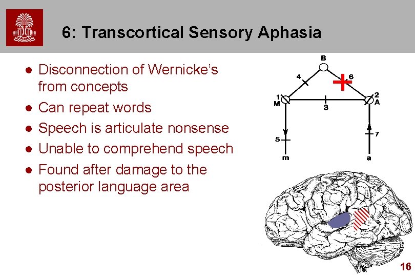 6: Transcortical Sensory Aphasia l l l Disconnection of Wernicke’s from concepts Can repeat