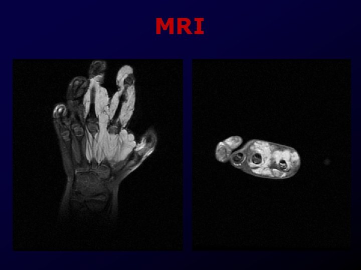 MRI 