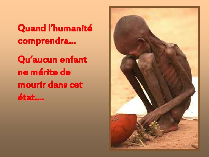 Quand l’humanité comprendra… Qu’aucun enfant ne mérite de mourir dans cet état…. 