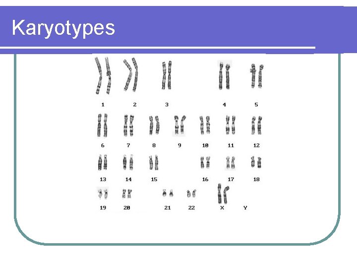 Karyotypes Karyotypes